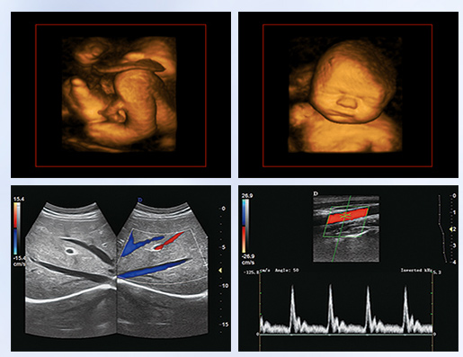 彩超機(jī)檢測報告